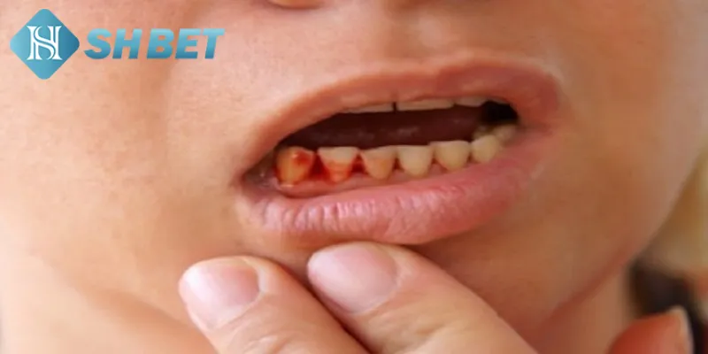 Các tình huống mơ nhổ răng thường gặp